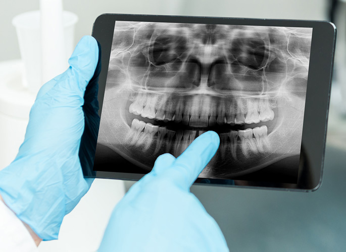 Person holding a tablet with an x-ray on it